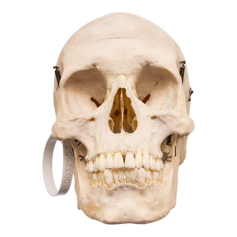 Real Human Skull