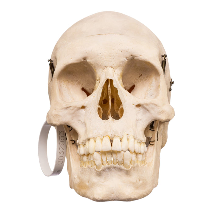 Real Human Skull