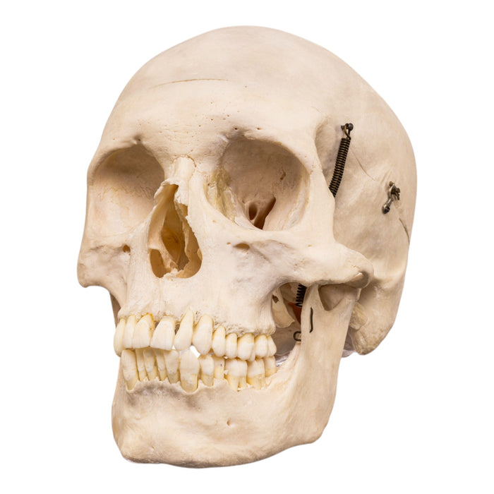 Real Human Skull