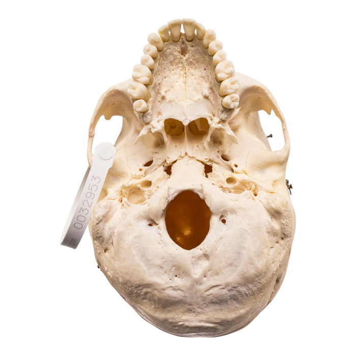 Real Human Skull