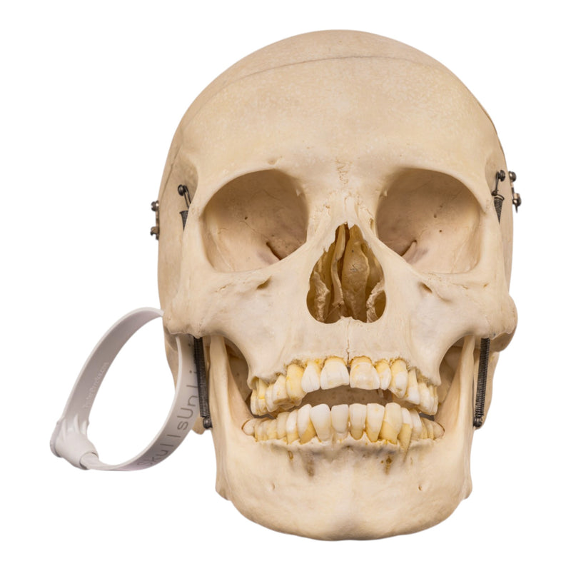 Real Human Skull