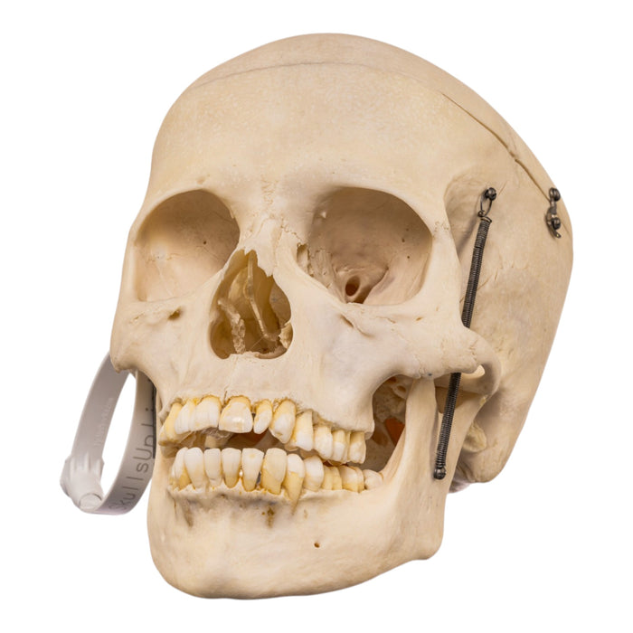 Real Human Skull