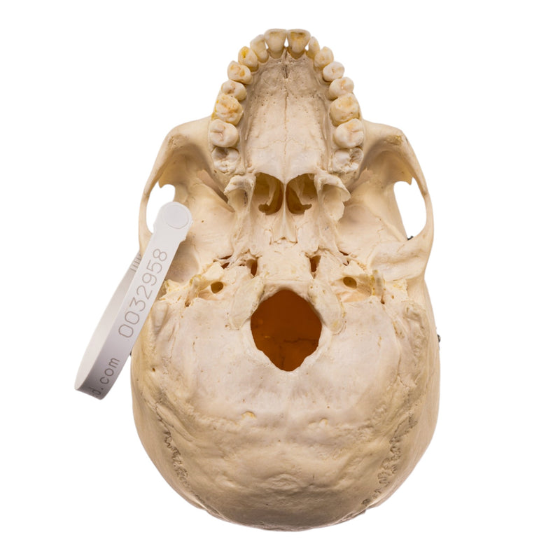 Real Human Skull
