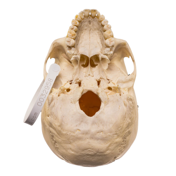 Real Human Skull