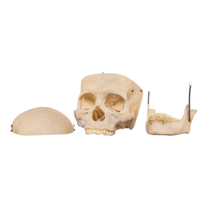 Real Human Skull