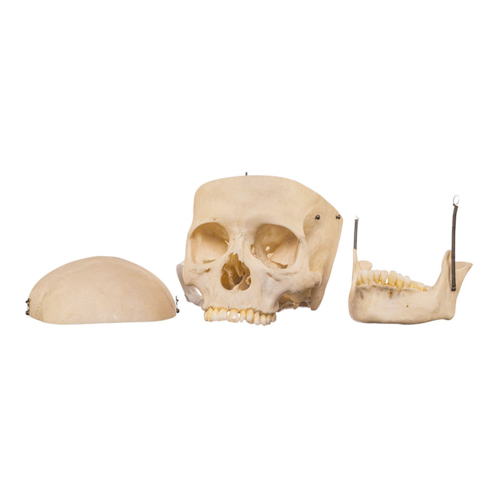 Real Human Skull