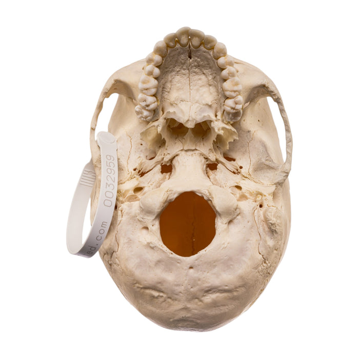 Real Human Skull