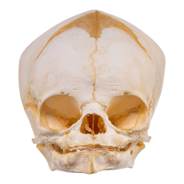 Real Human Fetal Skull