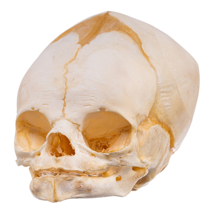 Real Human Fetal Skull