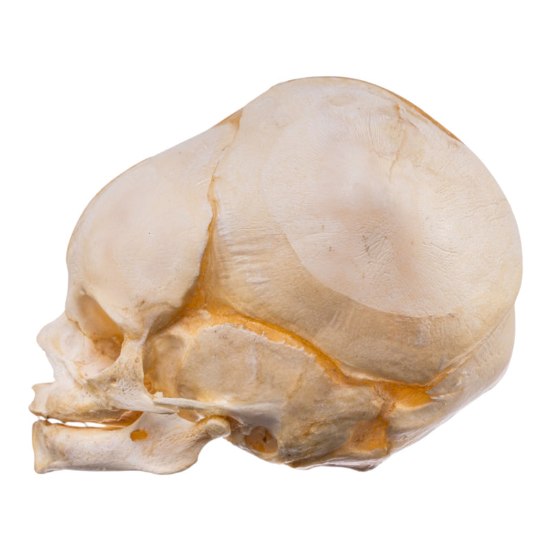 Real Human Fetal Skull
