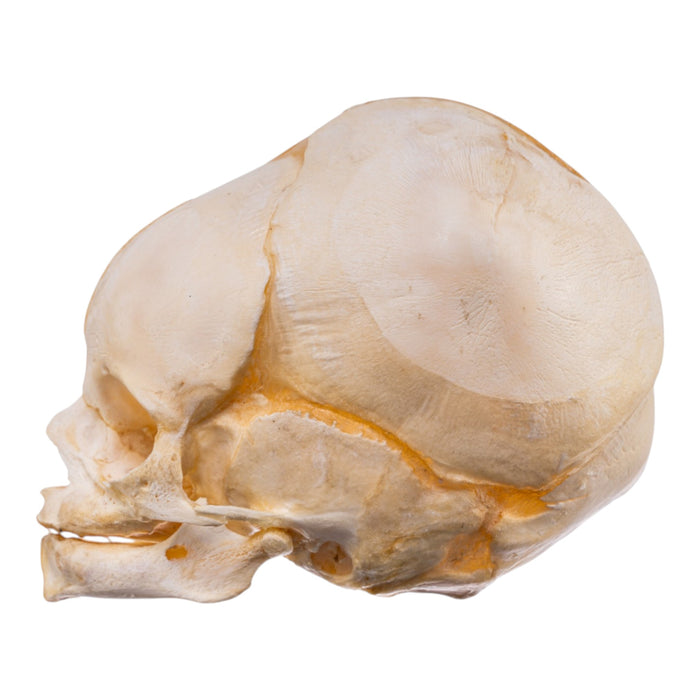 Real Human Fetal Skull