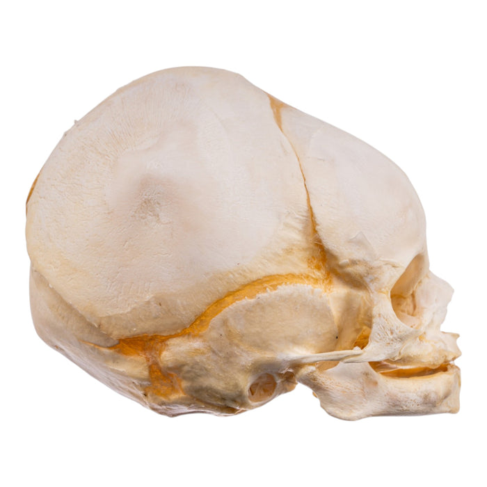 Real Human Fetal Skull