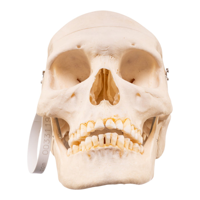 Real Human Skeleton - Disarticulated