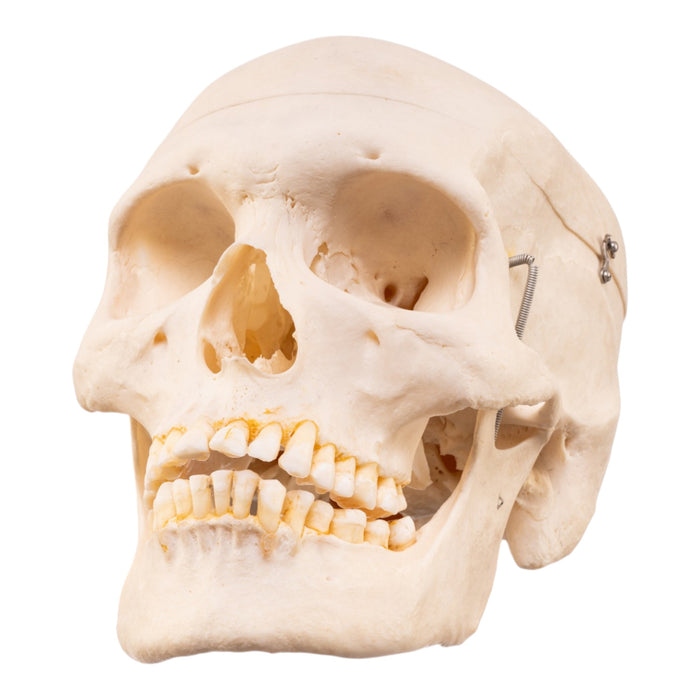 Real Human Skeleton - Disarticulated