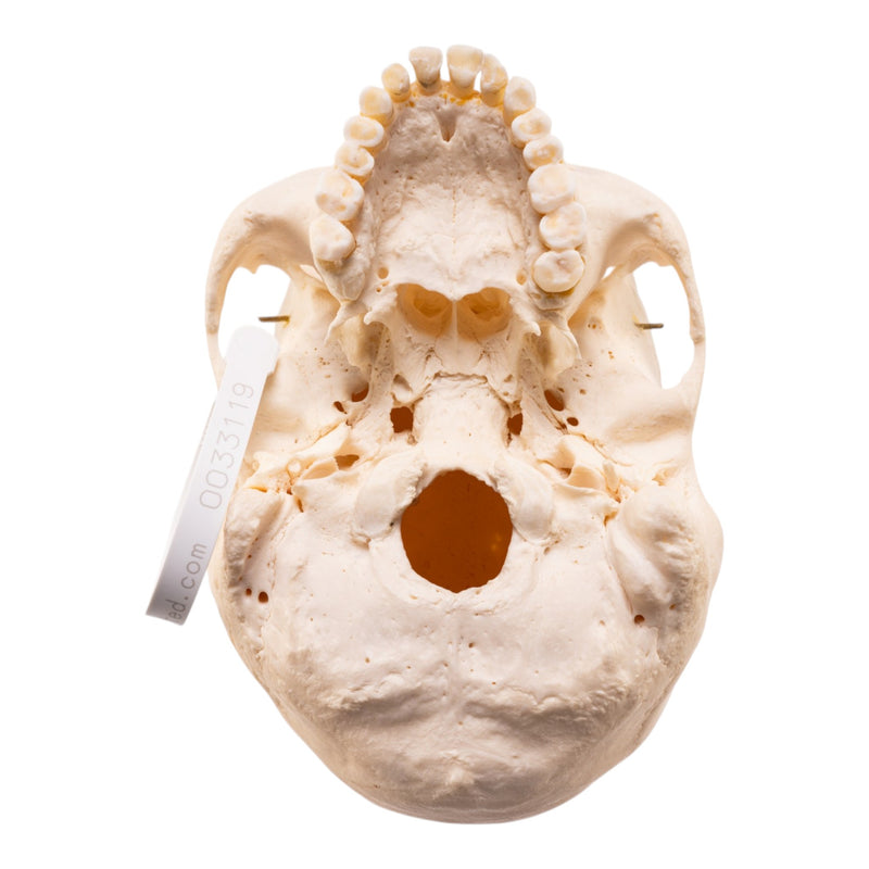 Real Human Skeleton - Disarticulated
