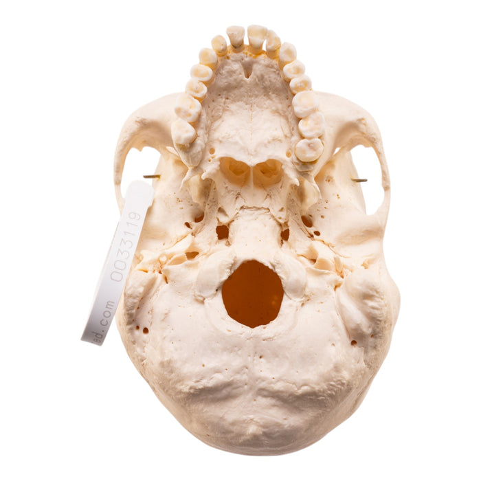 Real Human Skeleton - Disarticulated