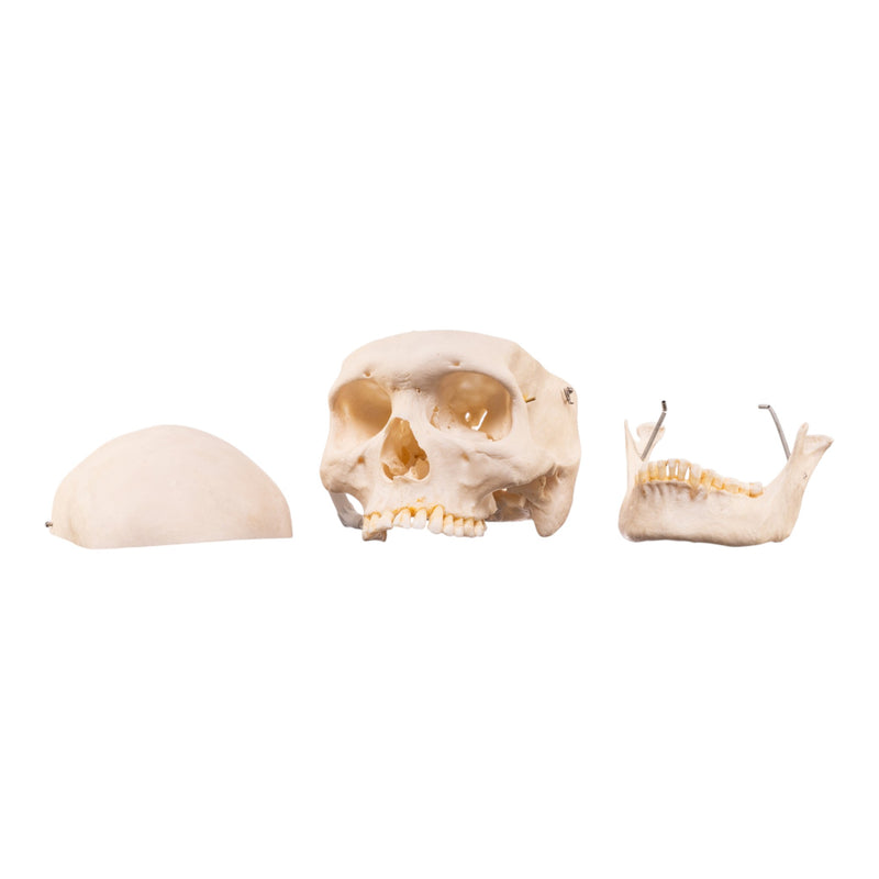 Real Human Skeleton - Disarticulated