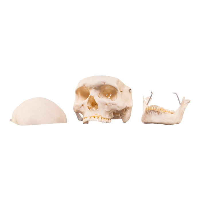 Real Human Skeleton - Disarticulated