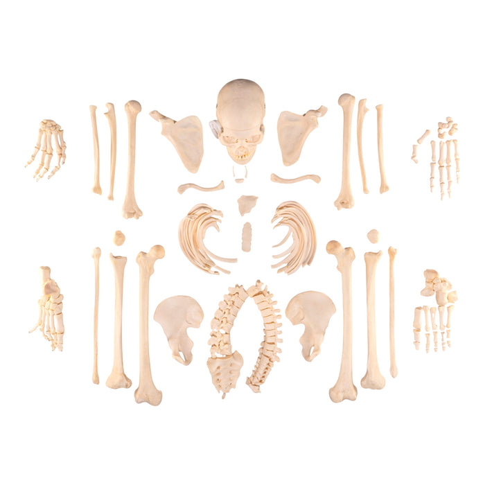 Real Human Skeleton - Disarticulated