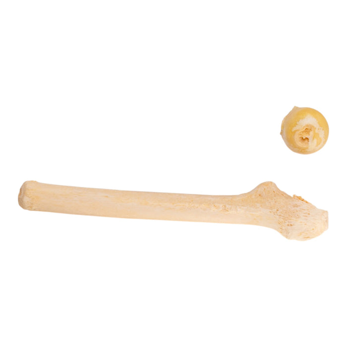 Real Human Skeleton - Partial - Pathology