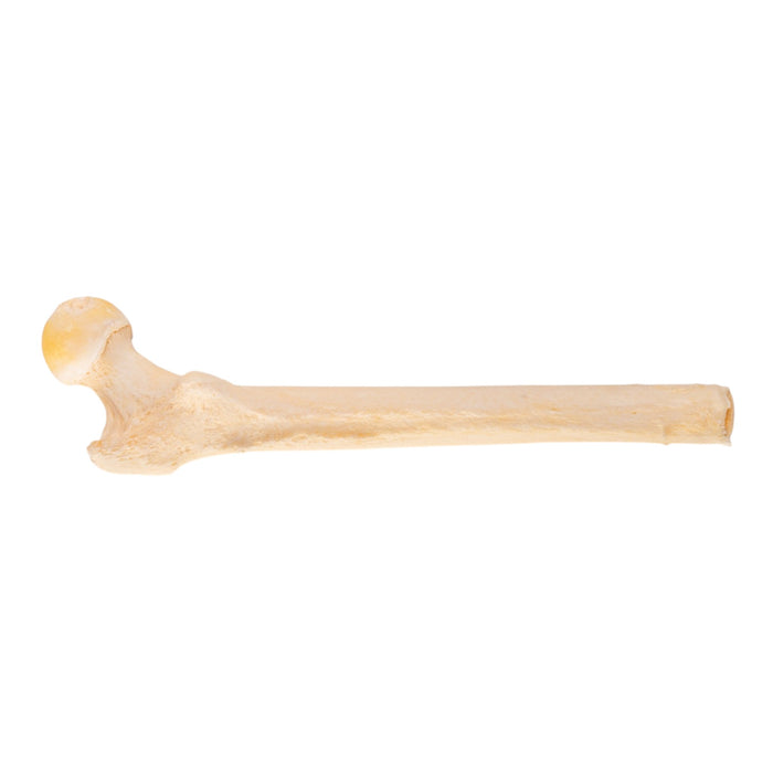 Real Human Skeleton - Partial - Pathology