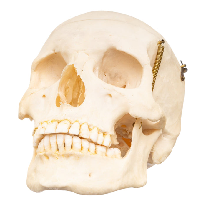 Real Human Skull with Carrying Case