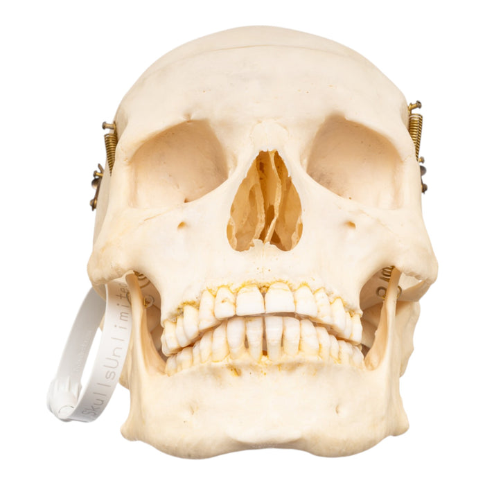 Real Human Skull with Carrying Case