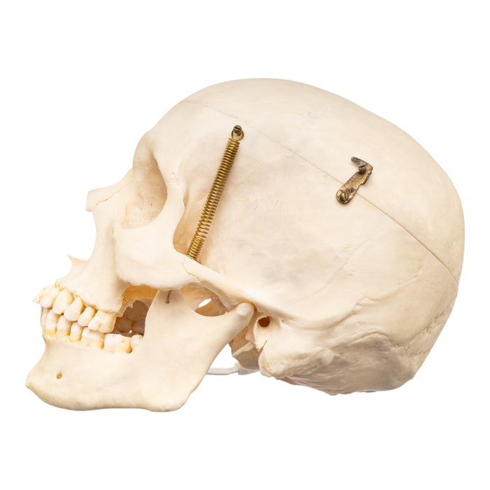 Real Human Skull with Carrying Case