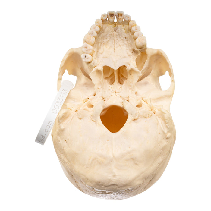 Real Human Skull with Carrying Case
