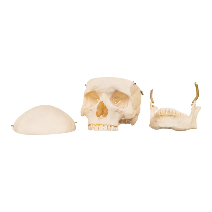 Real Human Skull with Carrying Case