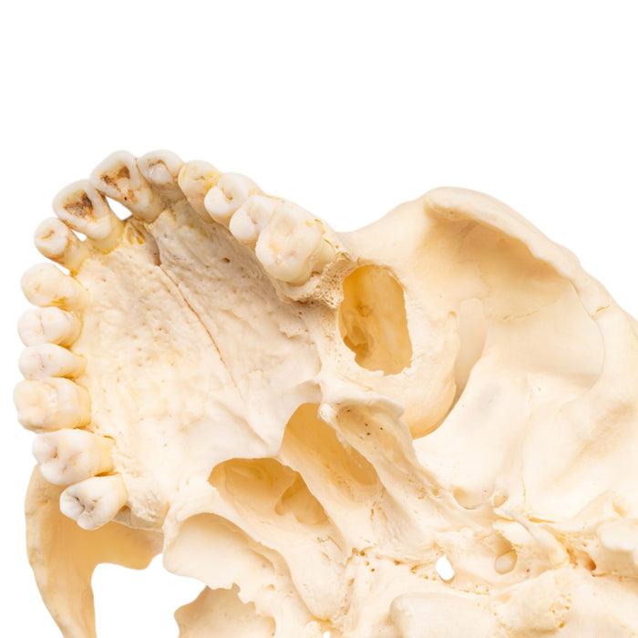 Real Human Skull with Carrying Case