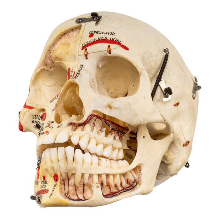 Real Human Skull - Dissected - with Carrying Case