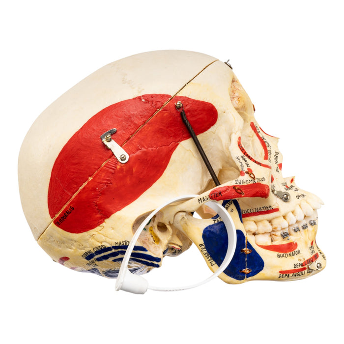 Real Human Skull - Dissected - with Carrying Case