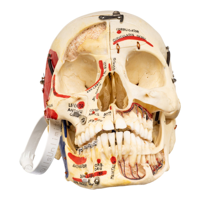 Real Human Skull - Dissected - with Carrying Case