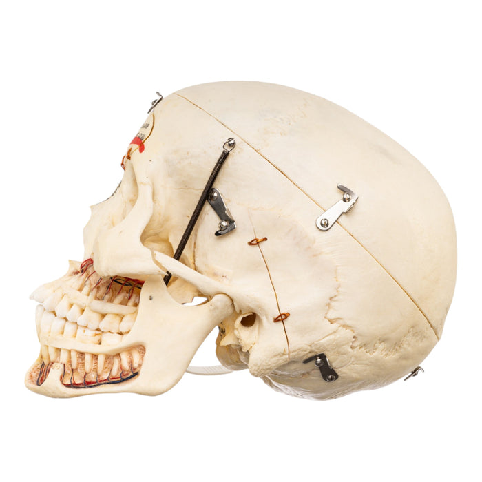 Real Human Skull - Dissected - with Carrying Case