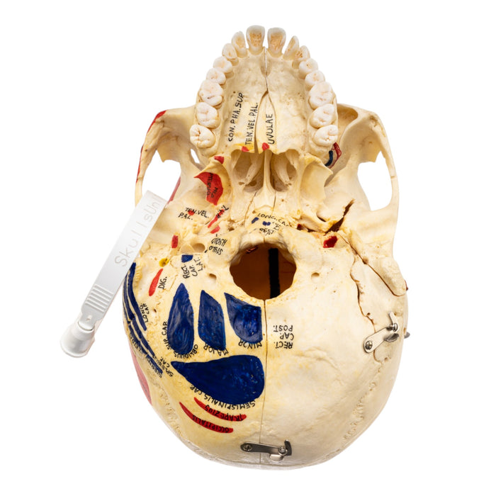 Real Human Skull - Dissected - with Carrying Case