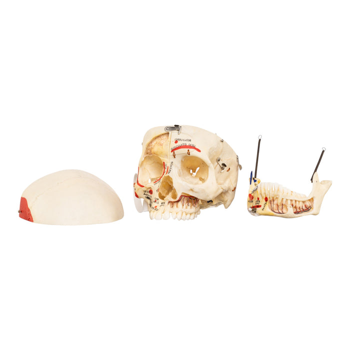 Real Human Skull - Dissected - with Carrying Case