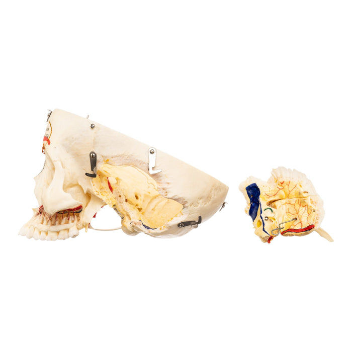 Real Human Skull - Dissected - with Carrying Case