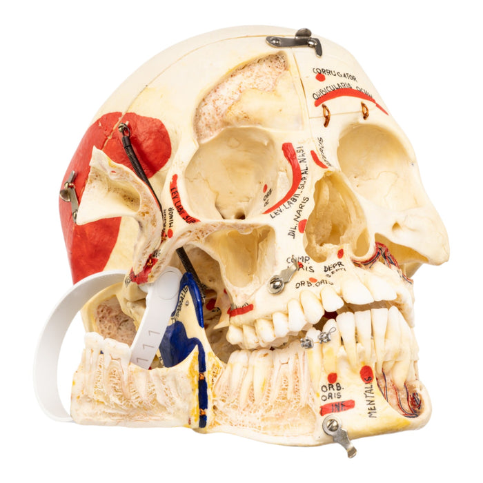 Real Human Skull - Dissected - with Carrying Case