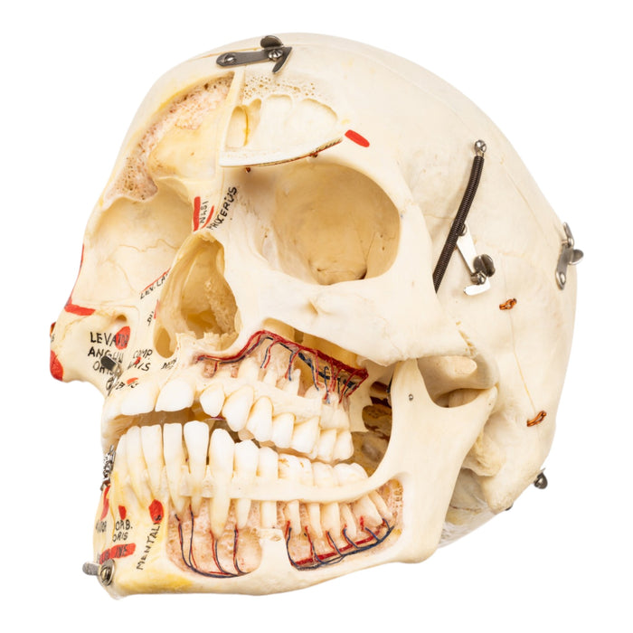 Real Human Skull - Dissected - with Carrying Case