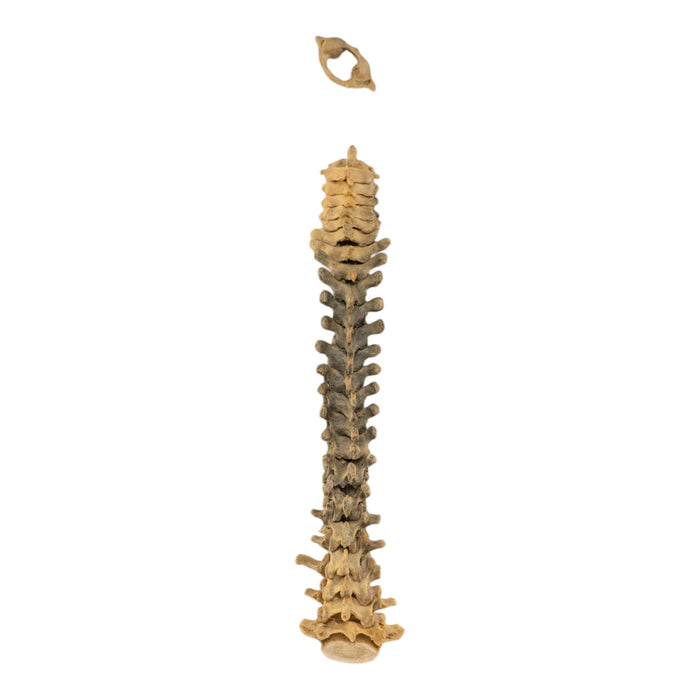Real Loosely Strung Human Spine