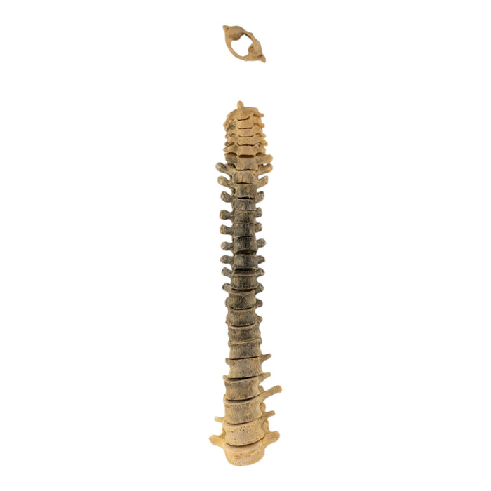 Real Loosely Strung Human Spine