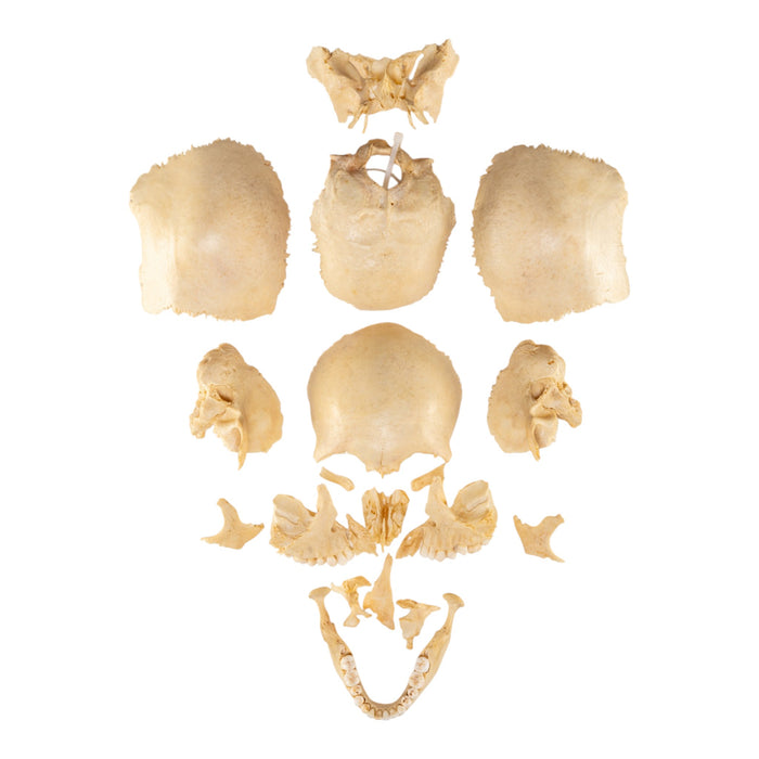 Real Human Disarticulated Skull