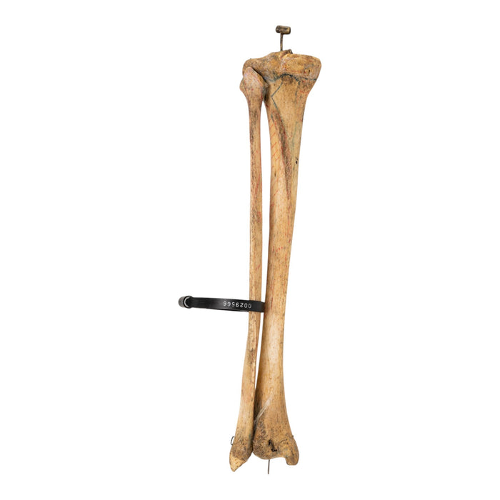 Real Human Tibia and Fibula - Articulated and Painted