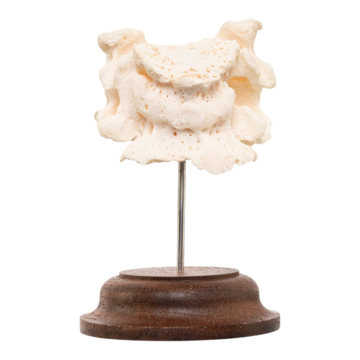 Real Human Vertebrae Set