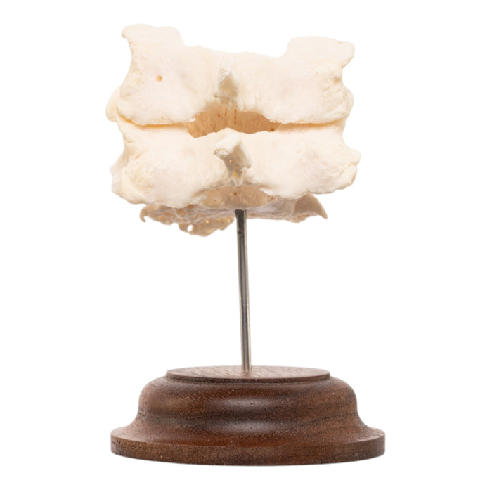 Real Human Vertebrae Set