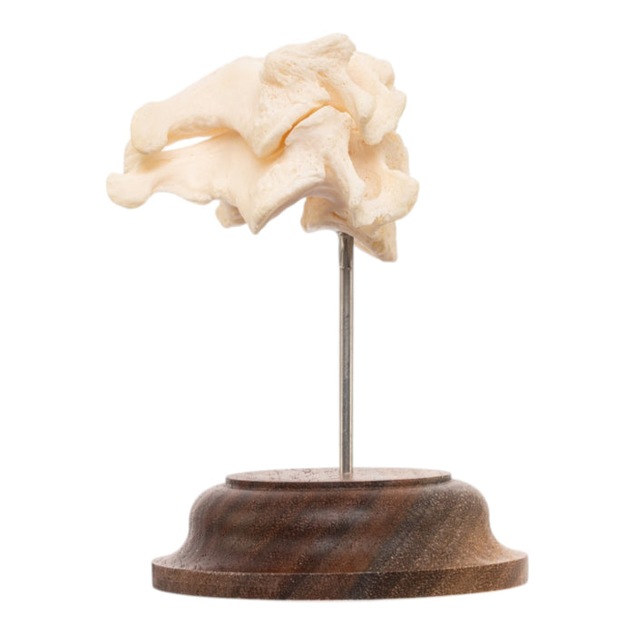 Real Human Vertebrae Set