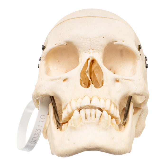 Real Human Skull
