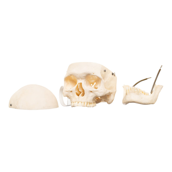 Real Human Skull