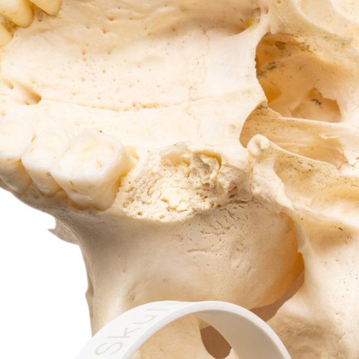 Real Human Skull